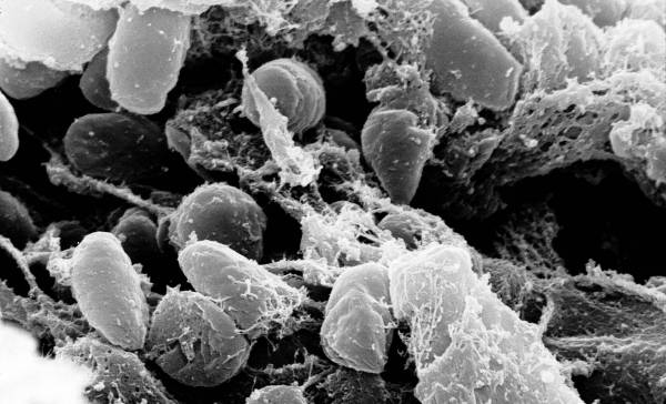 Pestbacterie al 7.000 jaar oud